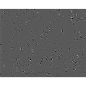 KRC/Y Cell|人肾癌细胞