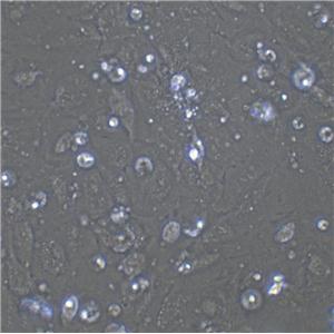 OVCA433 Cell|人卵巢癌细胞