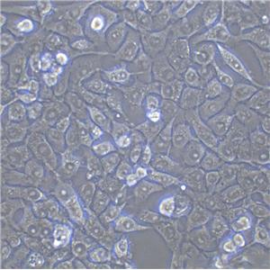 4-1st Cell|人胃癌细胞