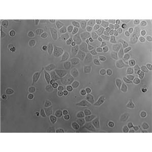 HCT 8 Cell|人结直肠腺癌细胞