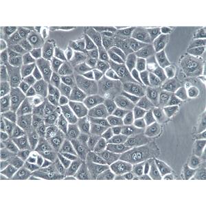 BC-025 Cell|人乳腺癌细胞
