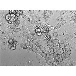 BC-009 Cell|人乳腺癌细胞