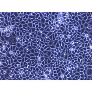 QG-56 Cell|人肺扁平上皮癌细胞