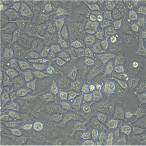 Chang liver Cell|人张氏肝细胞