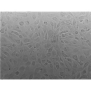 ECV-304 Cell|人脐静脉内皮细胞