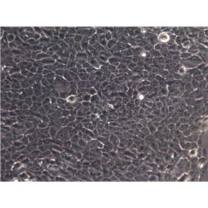RIN-m Cell|褐鼠胰岛素瘤上皮细胞