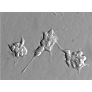 MC-26 Cell|小鼠结肠癌细胞