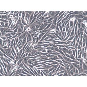 WPE-int Cell|人正常前列腺上皮细胞