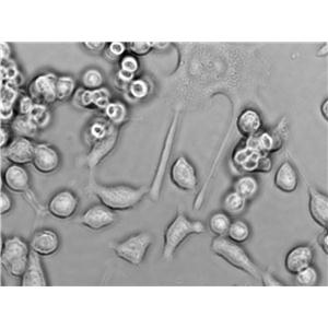 CHP-126 Cell|人成神经细胞