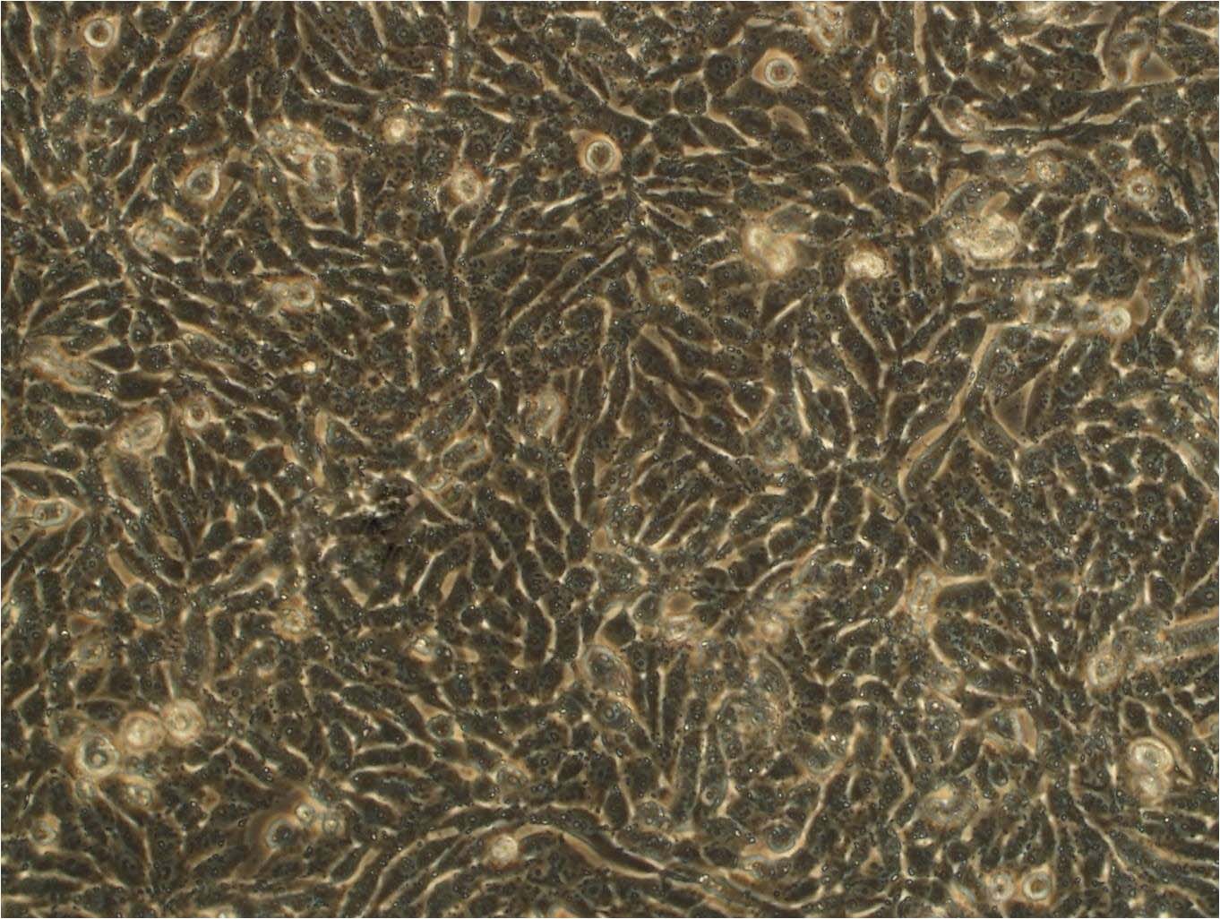 SK-N-BE(2)-M17 Cell|人成神经细胞,SK-N-BE(2)-M17 Cell
