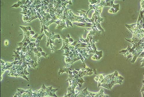 NCI-H2135 Cell|人肺癌细胞,NCI-H2135 Cell