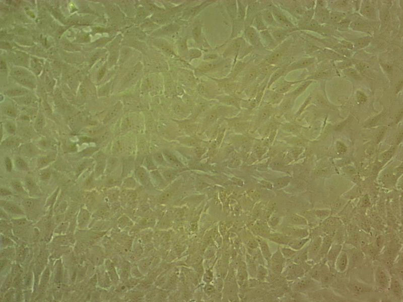 SNU-620 Cell|人胃癌细胞,SNU-620 Cell