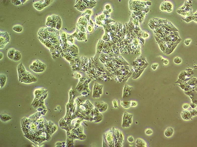 NUGC-2 Cell|人低分化胃癌腺癌細胞,NUGC-2 Cell