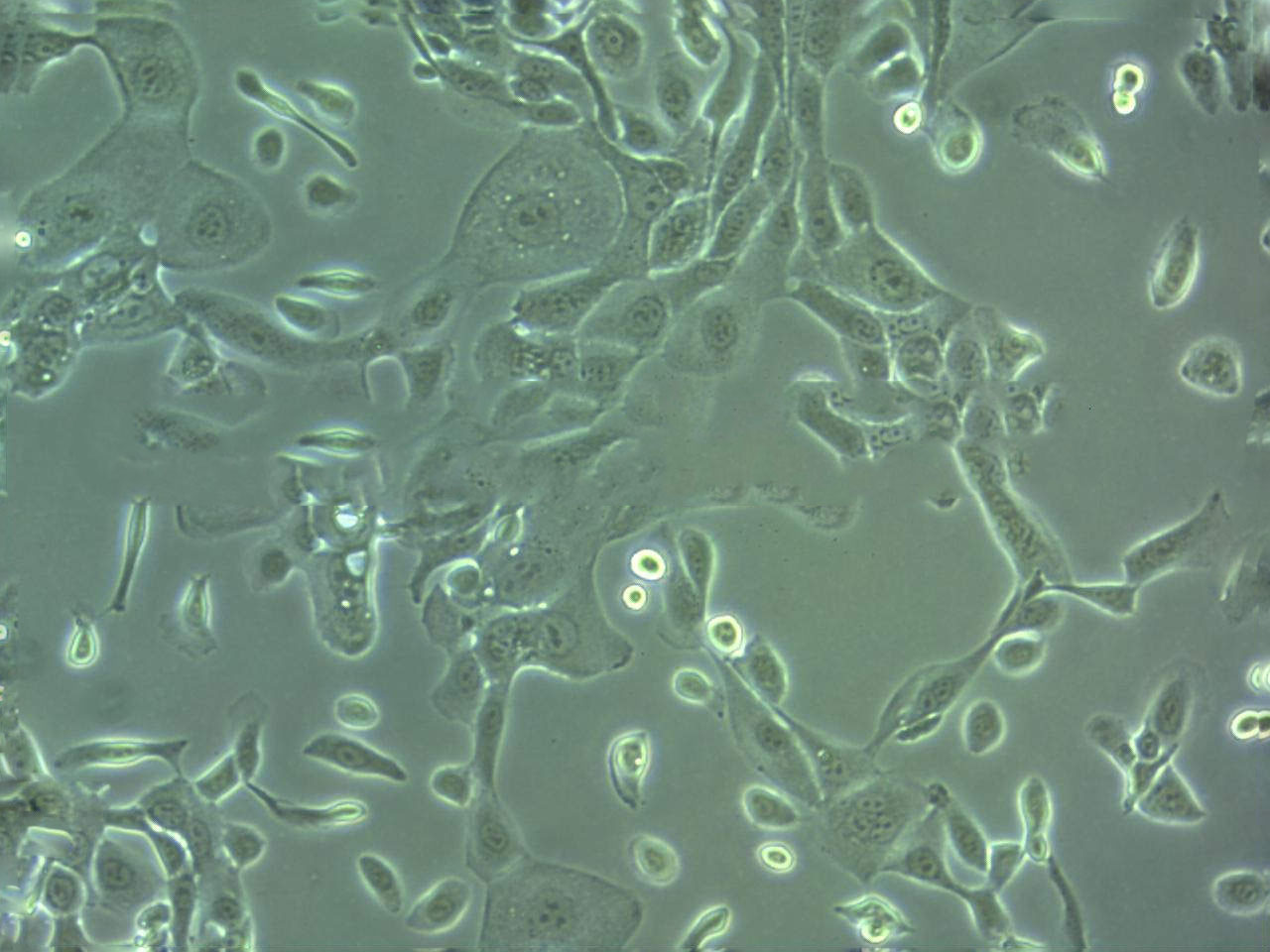 MGH-U3 Cell|人膀胱癌細(xì)胞,MGH-U3 Cell