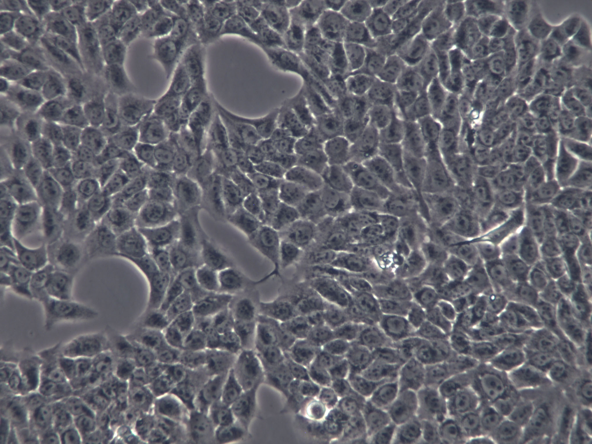 RPMI-1846 Cell|人黑色素瘤细胞,RPMI-1846 Cell