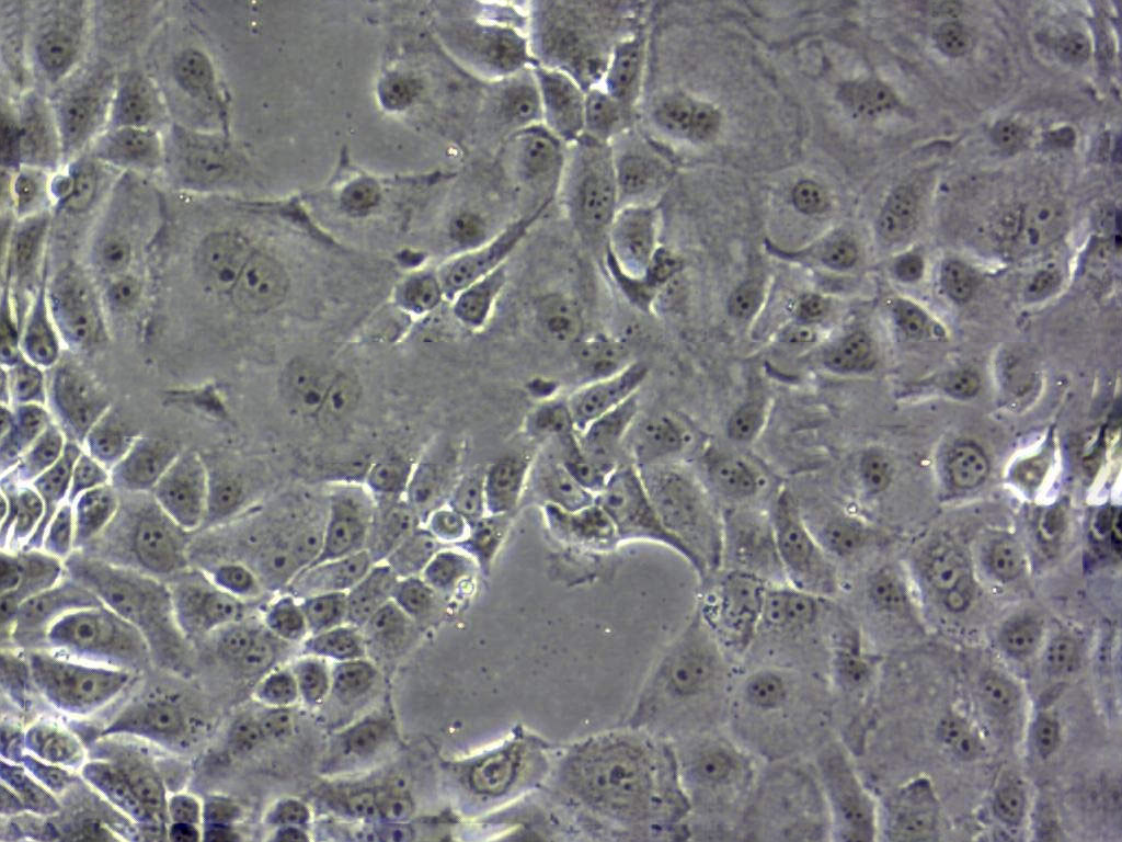 SNU-C2B Cell|人结直肠癌细胞,SNU-C2B Cell