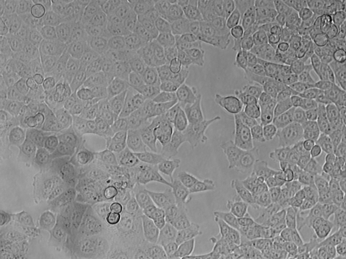 NCI-H676B Cell|人肺腺癌细胞,NCI-H676B Cell