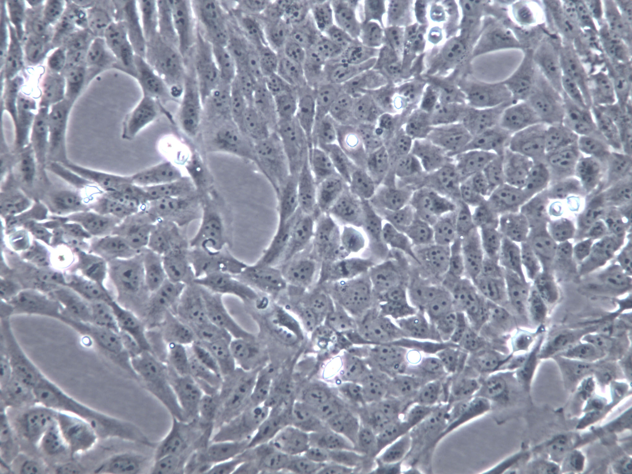 NCI-H1688 Cell|人肺癌细胞,NCI-H1688 Cell