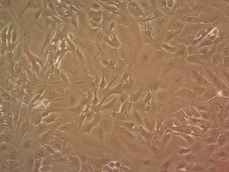 NCI-H1522 Cell|人肺癌细胞,NCI-H1522 Cell