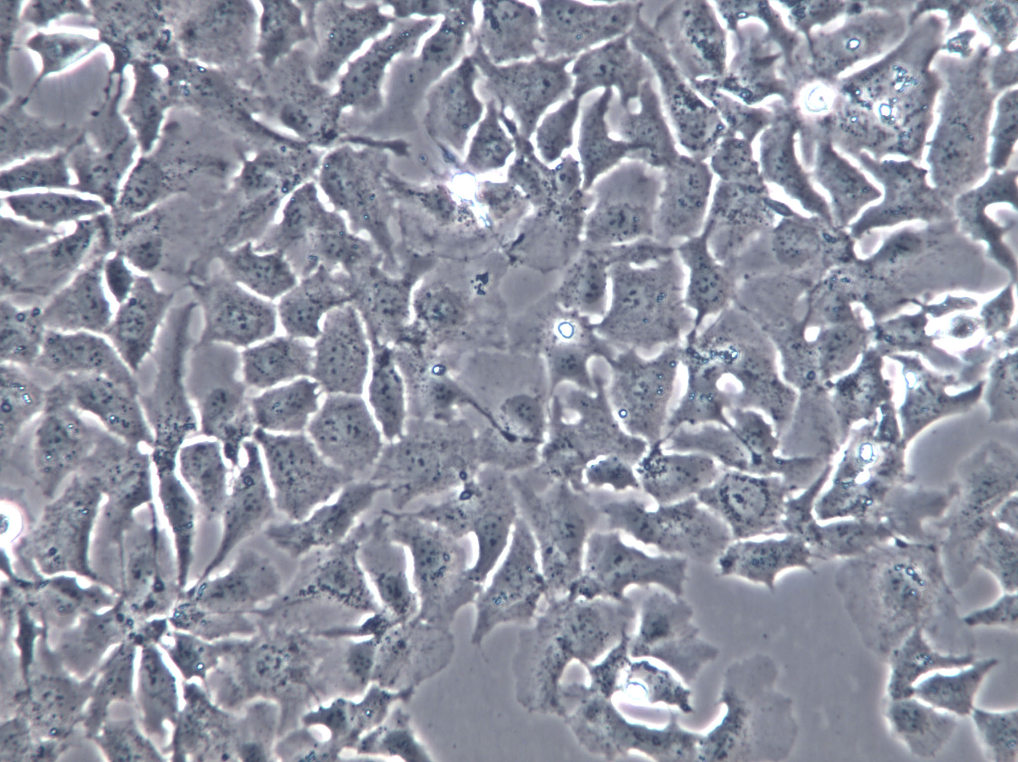 UK Pan-1 Cell|人胰腺導(dǎo)管上皮癌細(xì)胞,UK Pan-1 Cell