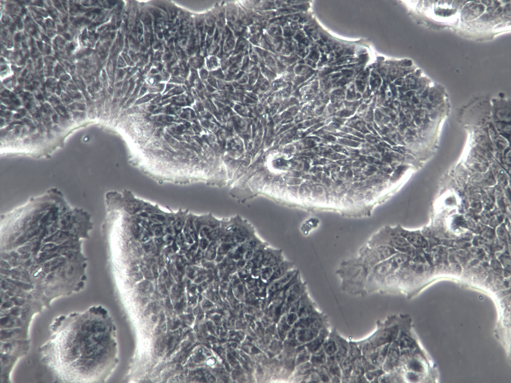 SW13 Cell|人肾上腺皮质瘤细胞,SW13 Cell