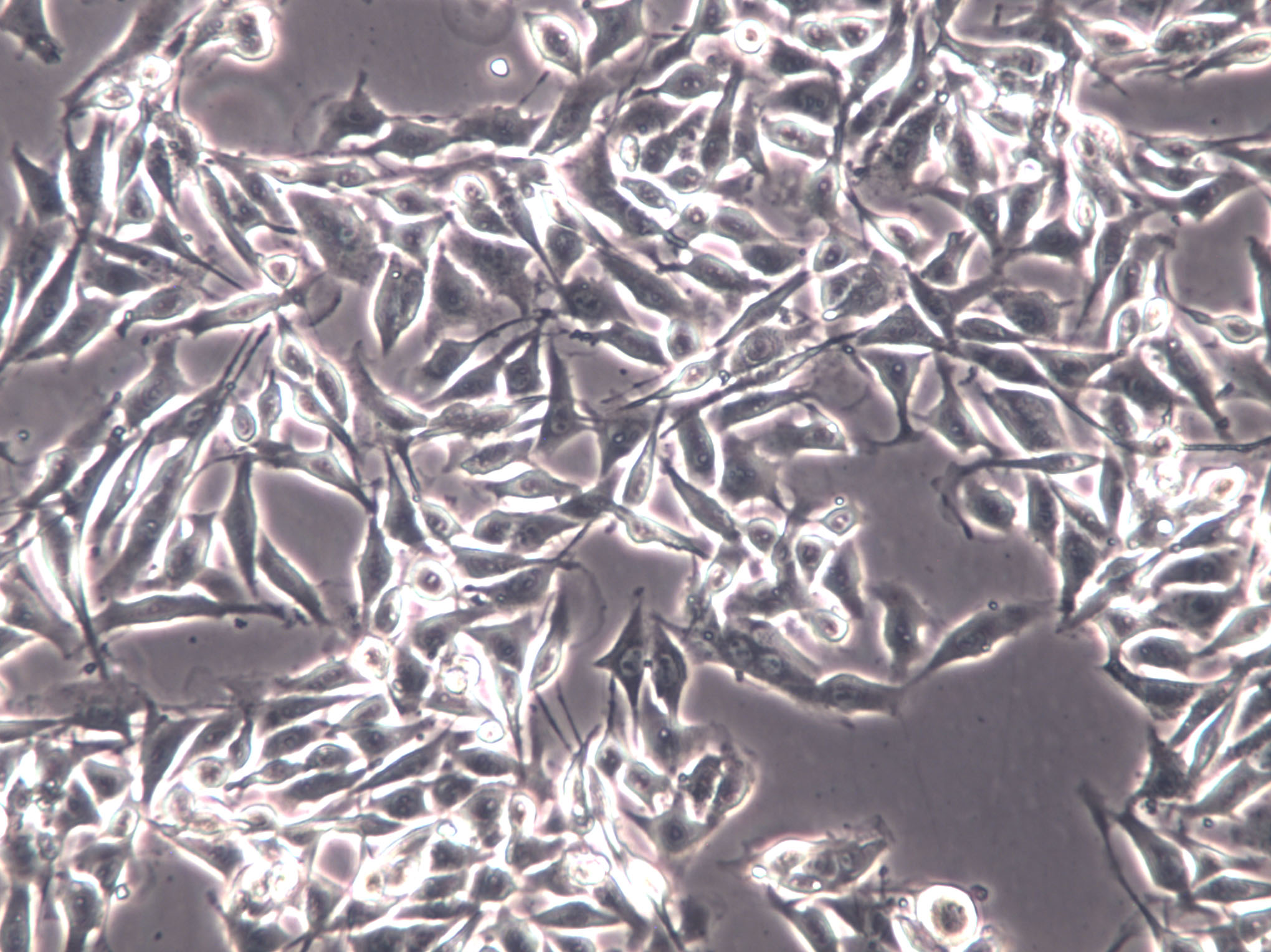 HLF Cell|人肺成纤维样细胞,HLF Cell