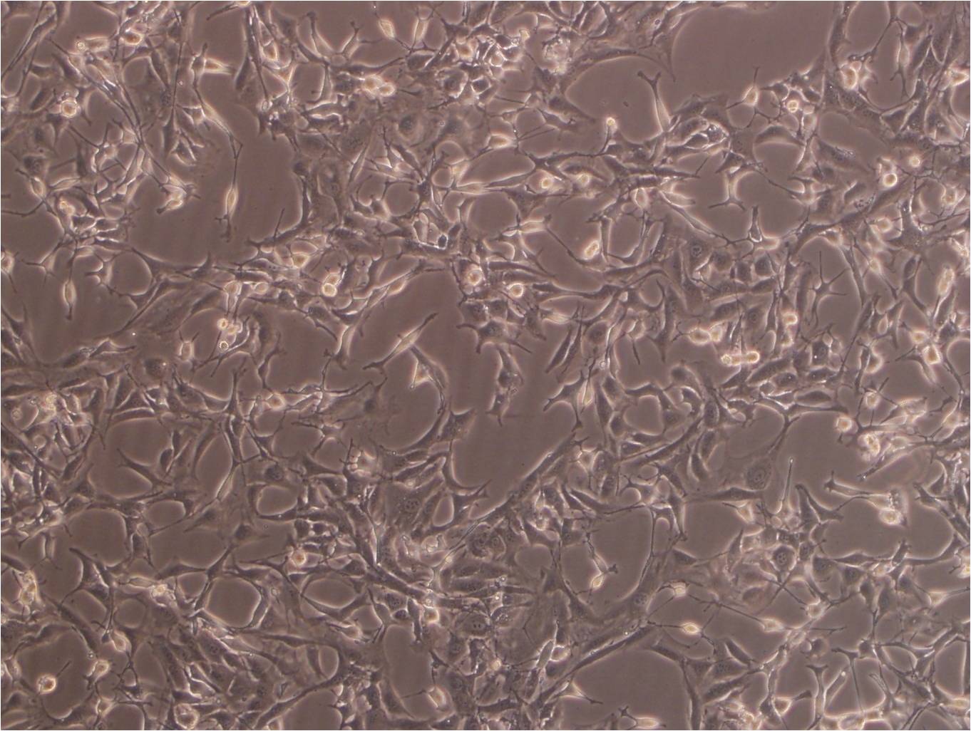 hfl1cell人肺成纖維細胞