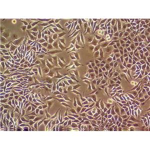 DV-90 Cell|人肺癌腺癌细胞