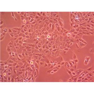 HCC1438 Cell|人肺癌细胞