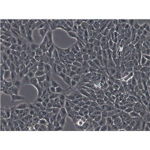 RPMI-1846 Cell|人黑色素瘤细胞,RPMI-1846 Cell