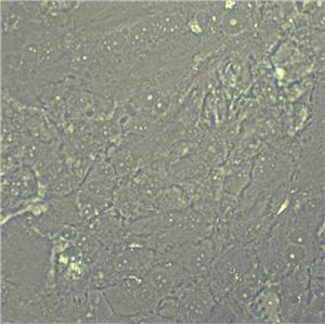 MRC-9 Cell|人胚肺细胞