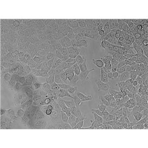 DMS 153 Cell|人小细胞肺癌细胞