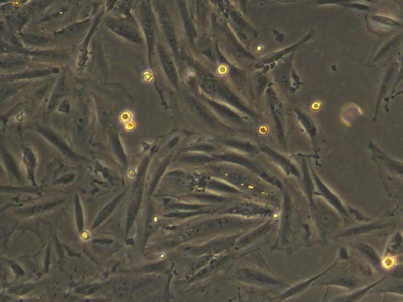 3T3-L1 Cell|小鼠前脂肪胚胎成纤维细胞,3T3-L1 Cell