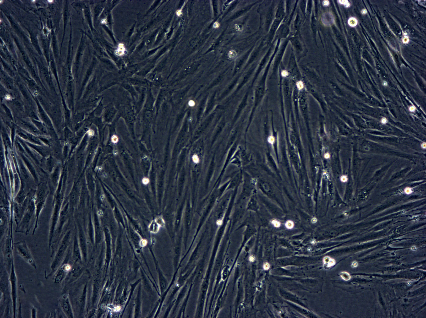 HFLS-RA Cell|类风湿关节炎成纤维样滑膜细胞,HFLS-RA Cell