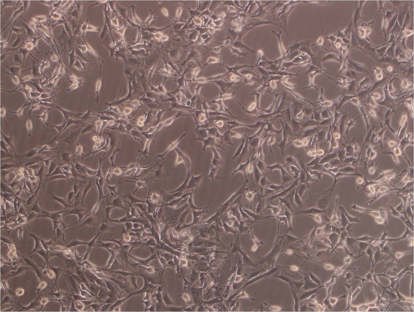 NRK-49F Cell|大鼠正常肾成纤维细胞,NRK-49F Cell