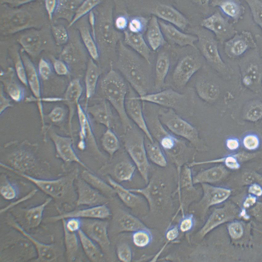 GM00637 Cell|人皮肤成纤维细胞,GM00637 Cell