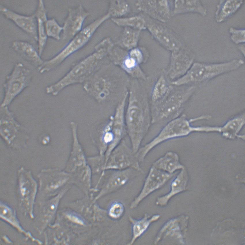 NOR-10 Cell|小鼠骨骼肌成纖維細(xì)胞,NOR-10 Cell