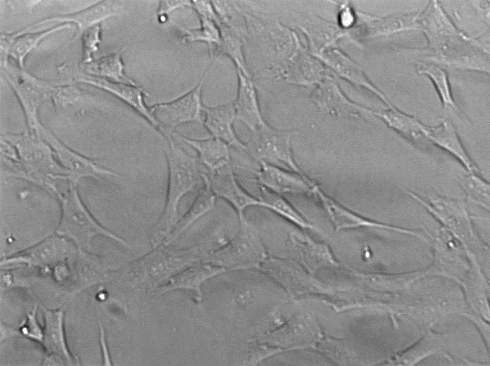 NCTC clone 929 Cell|小鼠成纤维细胞,NCTC clone 929 Cell