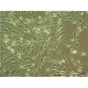 Hs27 Cell|人皮肤成纤维细胞