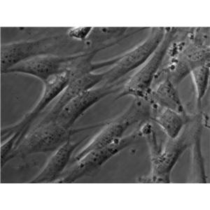 CCD-112CoN Cell|人结肠成纤维细胞
