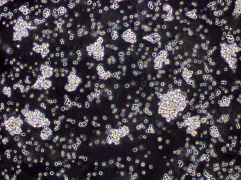 双歧杆菌BS培养基基础,Bifidobacterium BS Medium