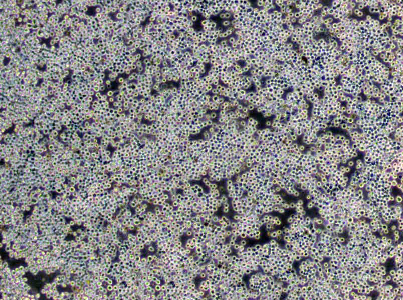 溶血琼脂培养基基础,Hemolysis Agar Base