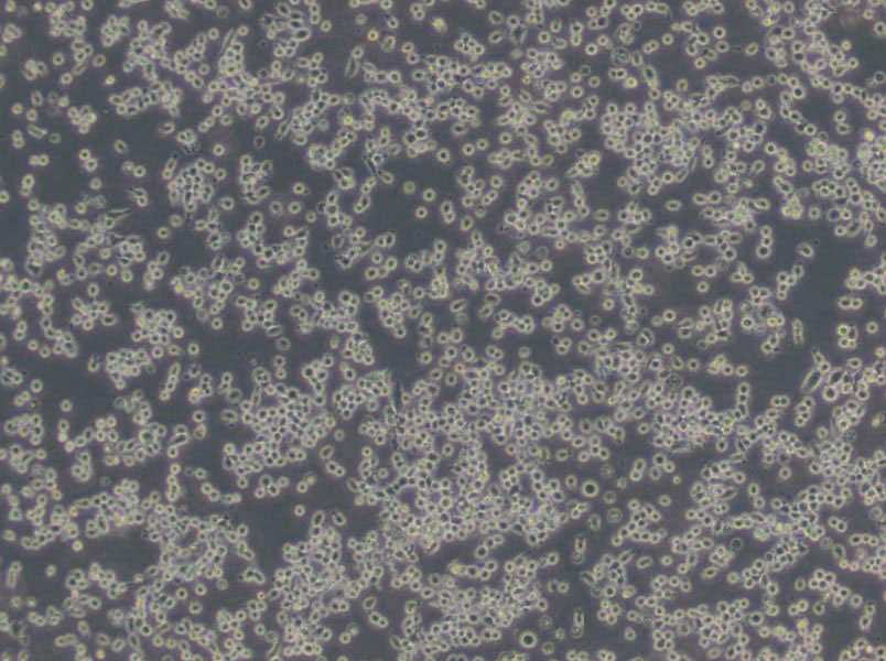 肺炎支原體肉湯基礎培養(yǎng)基,Mycoplasma pneumonia Broth Base