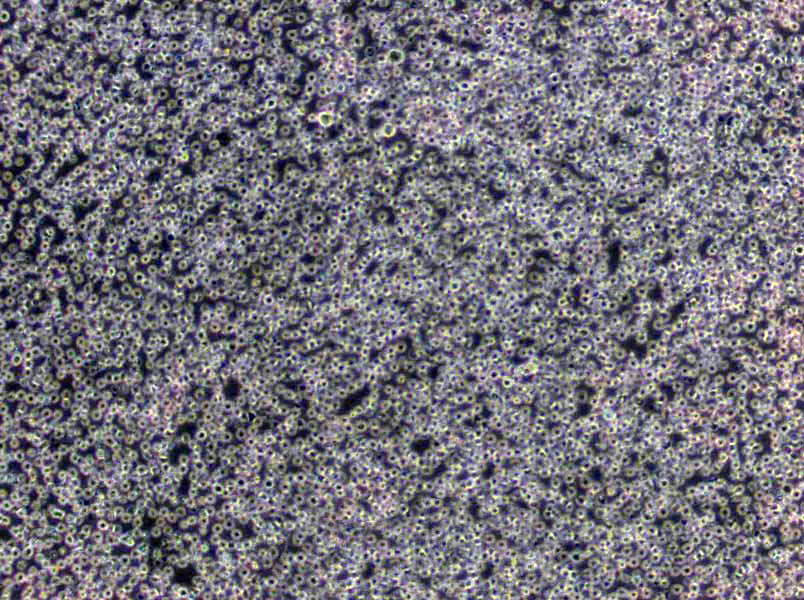 梭菌鉴别琼脂基础培养基,Differentia Clostridial Agar