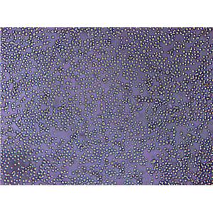 UT-7 Lymphoblast Cell|人类原巨核细胞型白血病传代细胞(有STR鉴定)