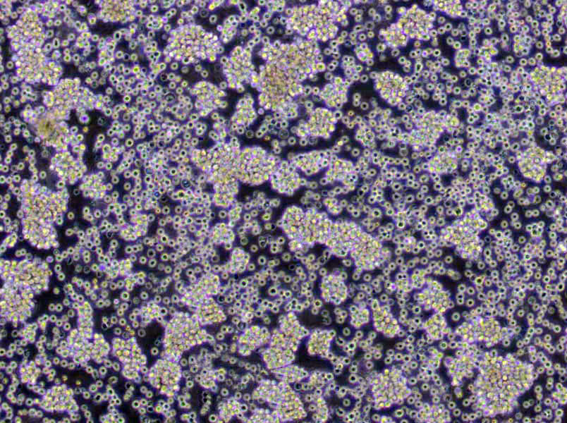 乳糖TTC瓊脂基礎(chǔ)培養(yǎng)基,Lactose TTC Agar Base