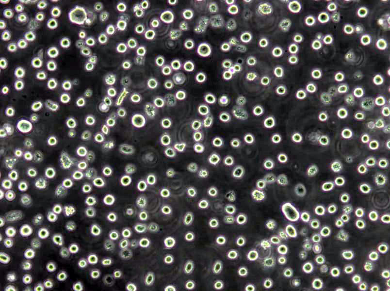 曙红亚甲蓝琼脂基础培养基,Eosin-Methylene Blue Lactose Agar