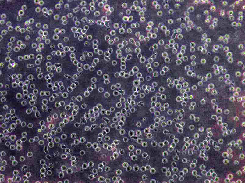 SUP-T1 Lymphoblast Cell|人淋巴母细胞淋巴瘤传代细胞(有STR鉴定),SUP-T1 Lymphoblast Cell