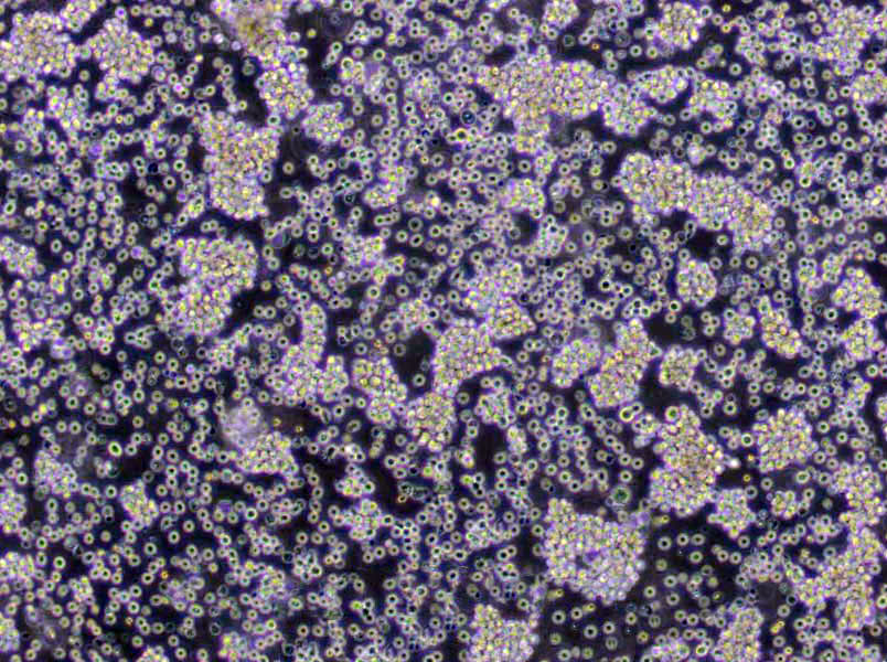 Loucy Lymphoblast Cell|人淋巴細胞白血病傳代細胞(有STR鑒定),Loucy Lymphoblast Cell