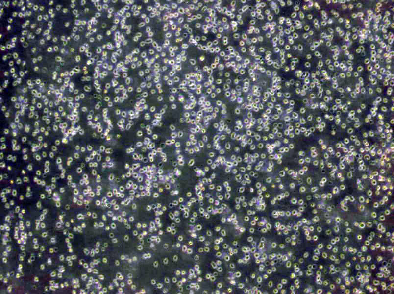 HuT 102 Lymphoblast Cell|人T淋巴瘤傳代細(xì)胞(有STR鑒定)HuT 102 Lymphoblast Cell|人T淋巴瘤傳代細(xì)胞(有STR鑒定),HuT 102 Lymphoblast Cell